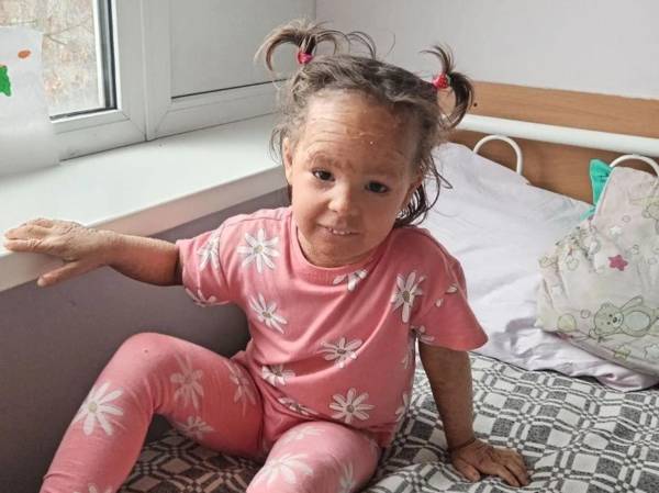 Лизе с ихтиозом нужны специальные уходовые средства