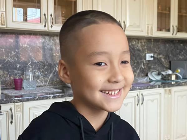Alikhan has a malignant retinal tumor — he needs a replacement eye prosthesis