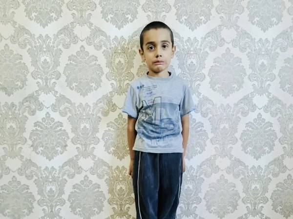 Khamza has a developmental speech delay. He needs rehabilitation to overcome the delay in his development