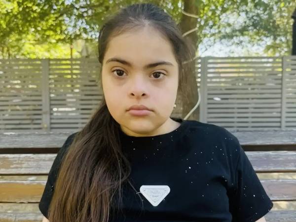 Dzhamilya with Down syndrome needs a rehabilitation course for further development.