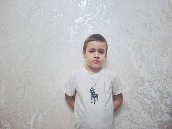 Abdurakhman has delayed psychoverbal development and autism. He needs rehabilitation to develop his cognitive and speech skills.