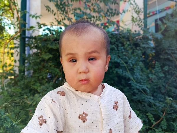 Tursina needs eye surgery!