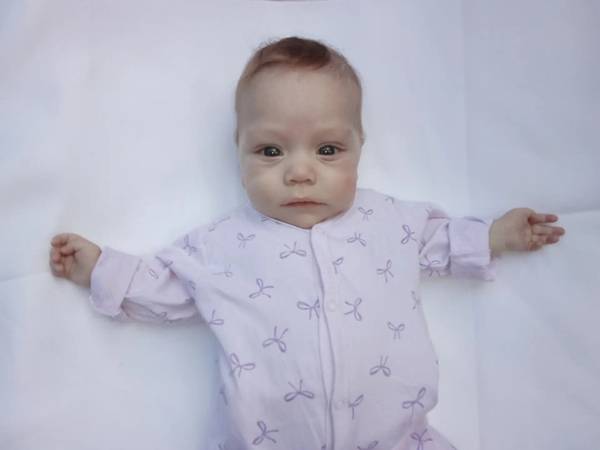 Safiya is in intensive care again. Please help the little girl continue her treatment