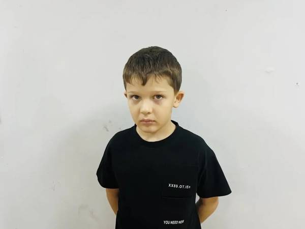 Abbas needs a rehabilitation course for autism correction.