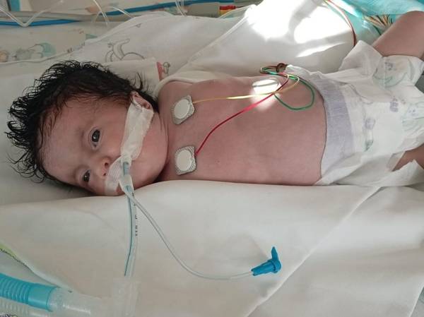 1.5-month-old Sumaya, who has a complex heart defect, needs surgery!