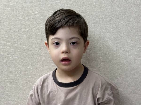 Aslan has Down syndrome, he needs to undergo rehabilitation