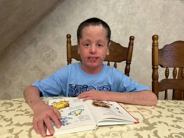 Tickets to doctors: let's support Rashid and other children with rare skin diseases