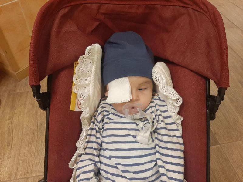 Dowodzha needs surgery on his other eye!