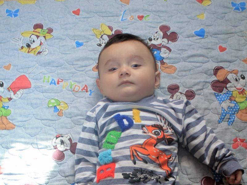 The operation will restore Elshod's eyesight!