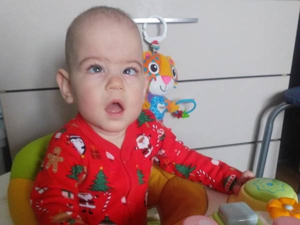 Roma needs surgery to correct strabismus!