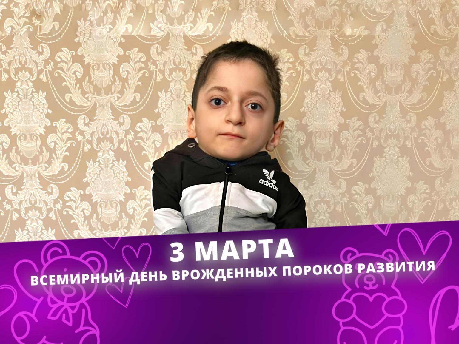 У Абдулкарима хрупкие кости из-за редкого заболевания. Он нуждается в операции на предплечьях