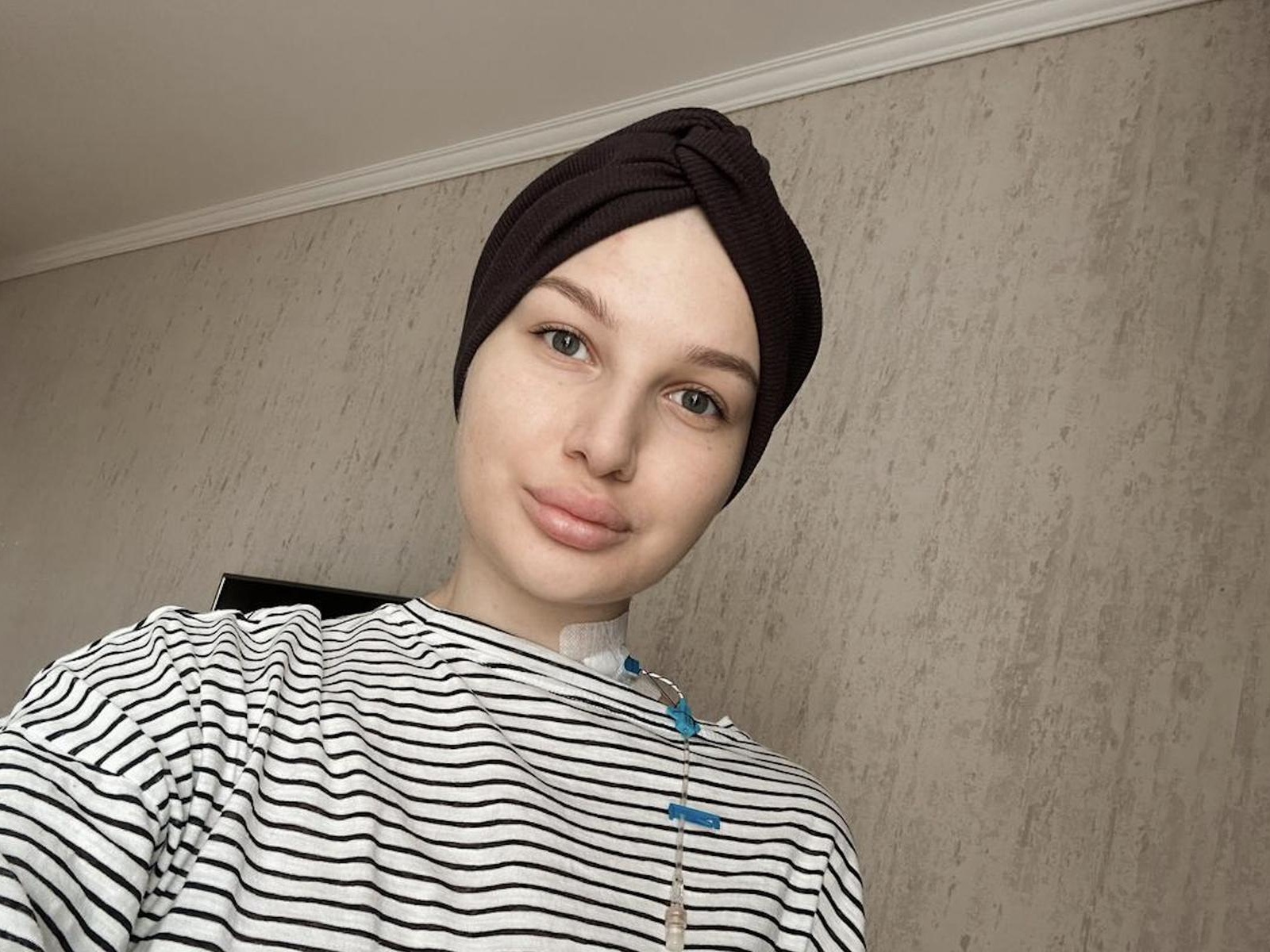 У Алины рак крови. Чтобы победить болезнь, ей нужна операция по пересадке костного мозга