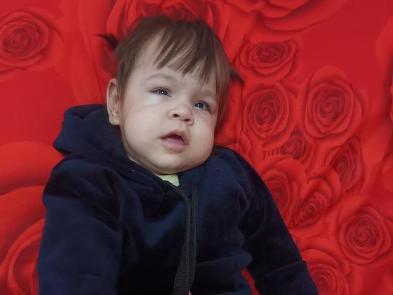 Самие нужна операция на глаза, чтобы восстановить зрение
