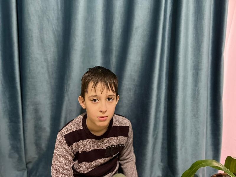 Асхаб нуждается во второй операции по исправлению косоглазия