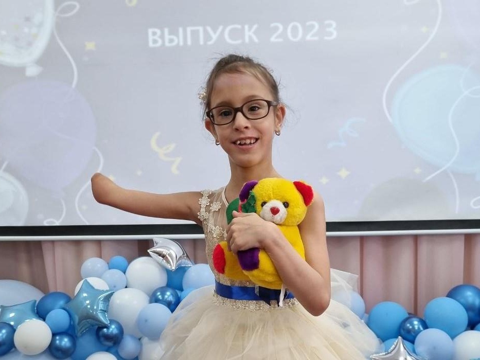 Anna needs a cyber prosthesis in her right hand!