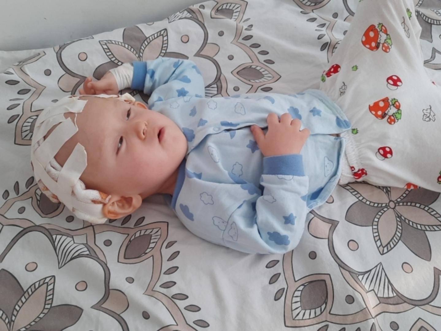 Karim needs skull surgery