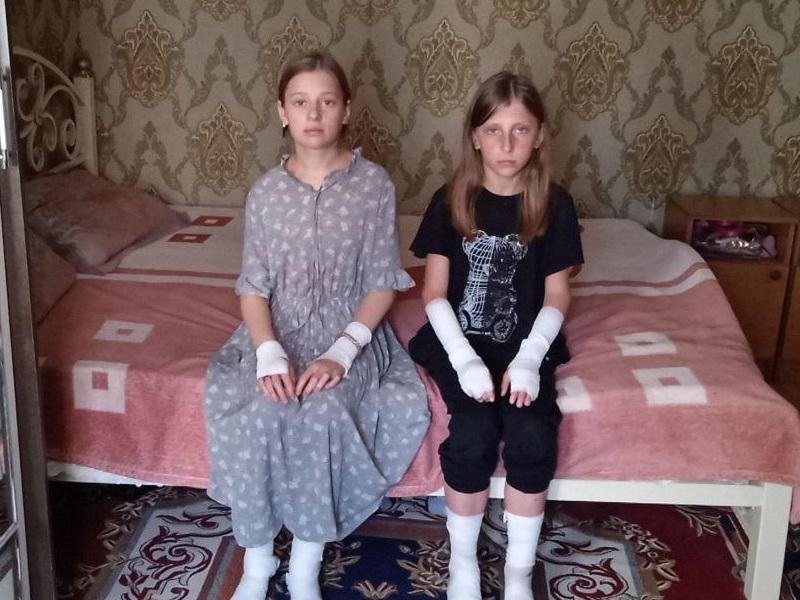 Асият и Саният нужны специальные кремы, чтобы легче переносить последствия кожного заболевания!