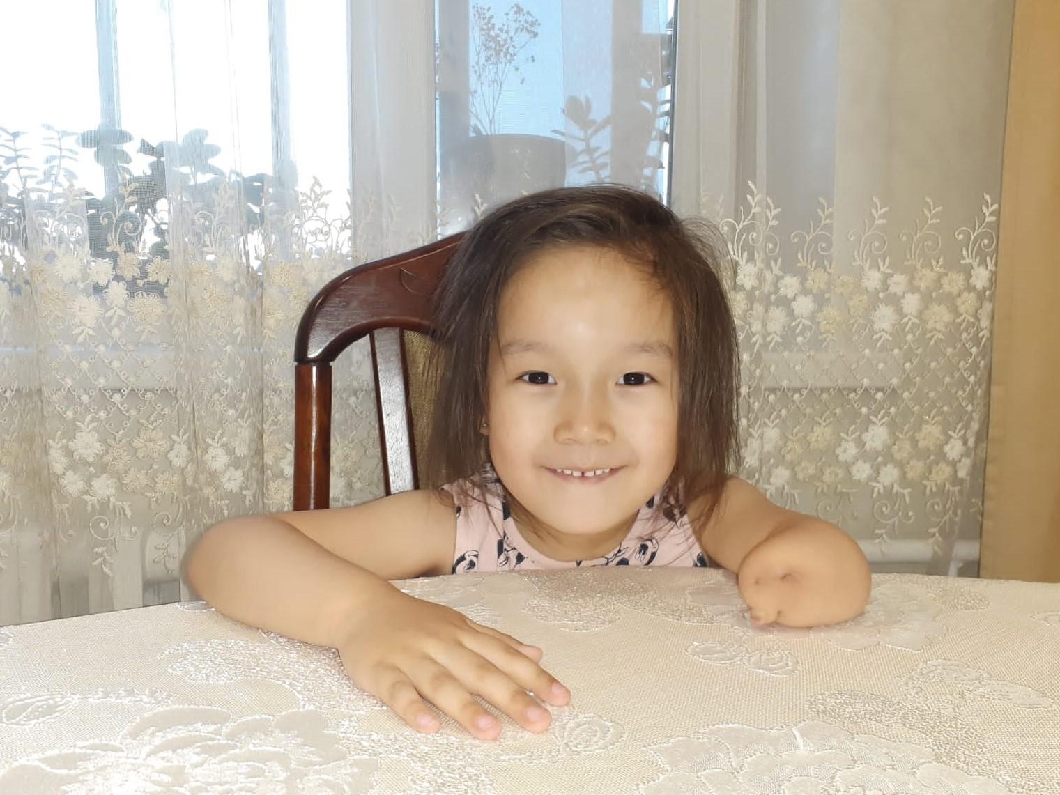 Dalida needs a cyber prosthesis in her left arm!