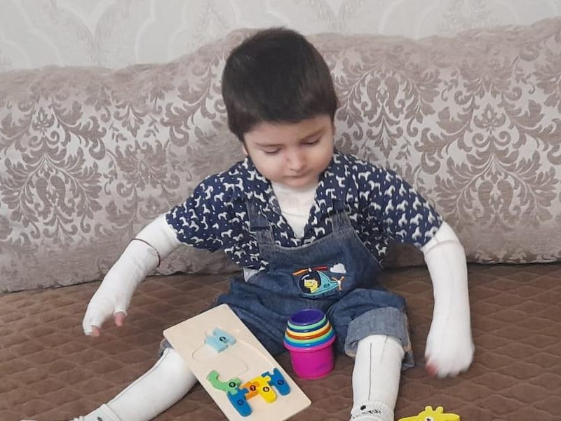 У Адама генетическое заболевание кожи. Ему нужны атравматические повязки и эластичные бинты для её защиты!
