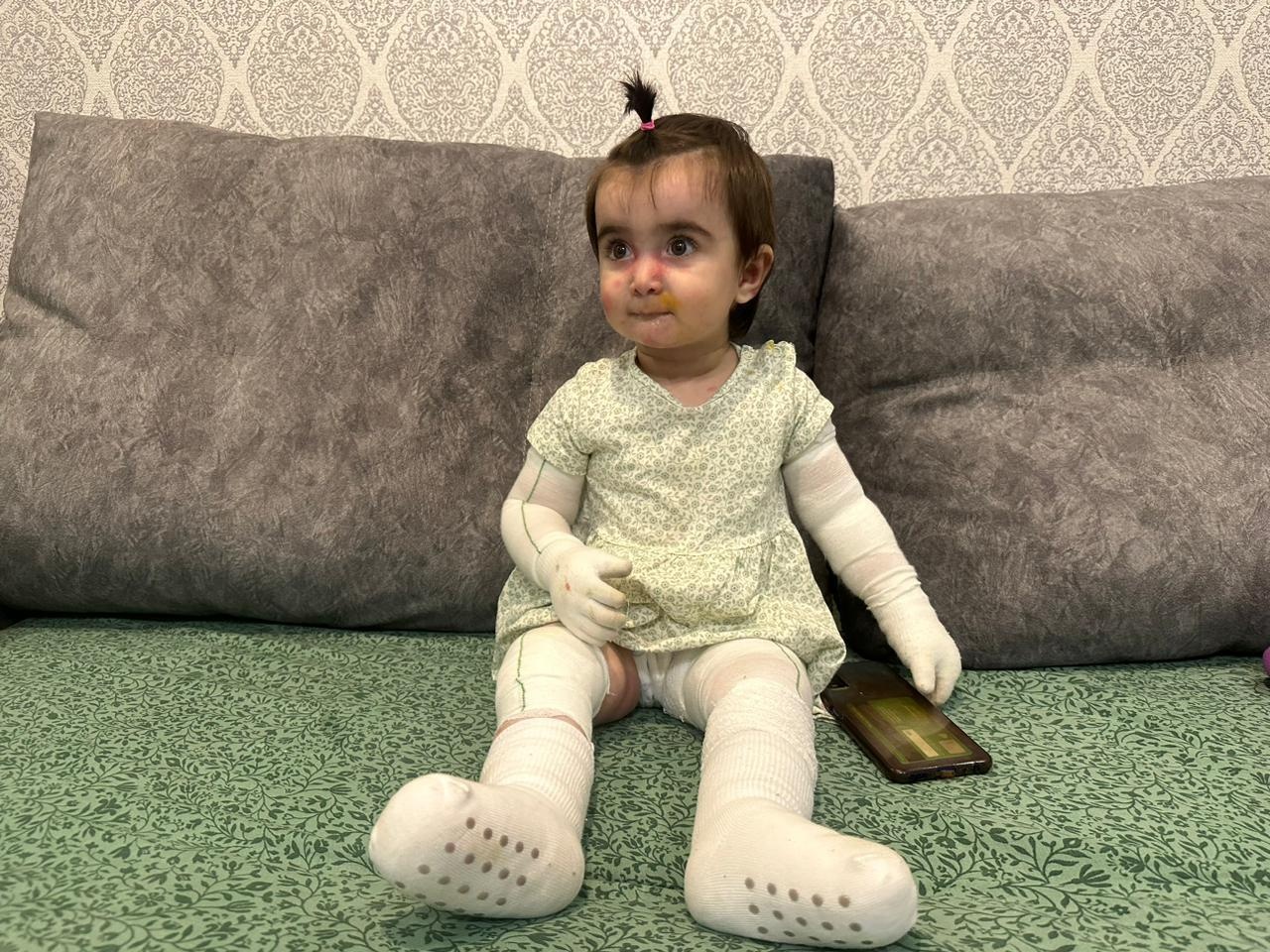 У Ясмины генетическое заболевание кожи, ей нужны специальные уходовые средства для очищения и восстановления кожи!