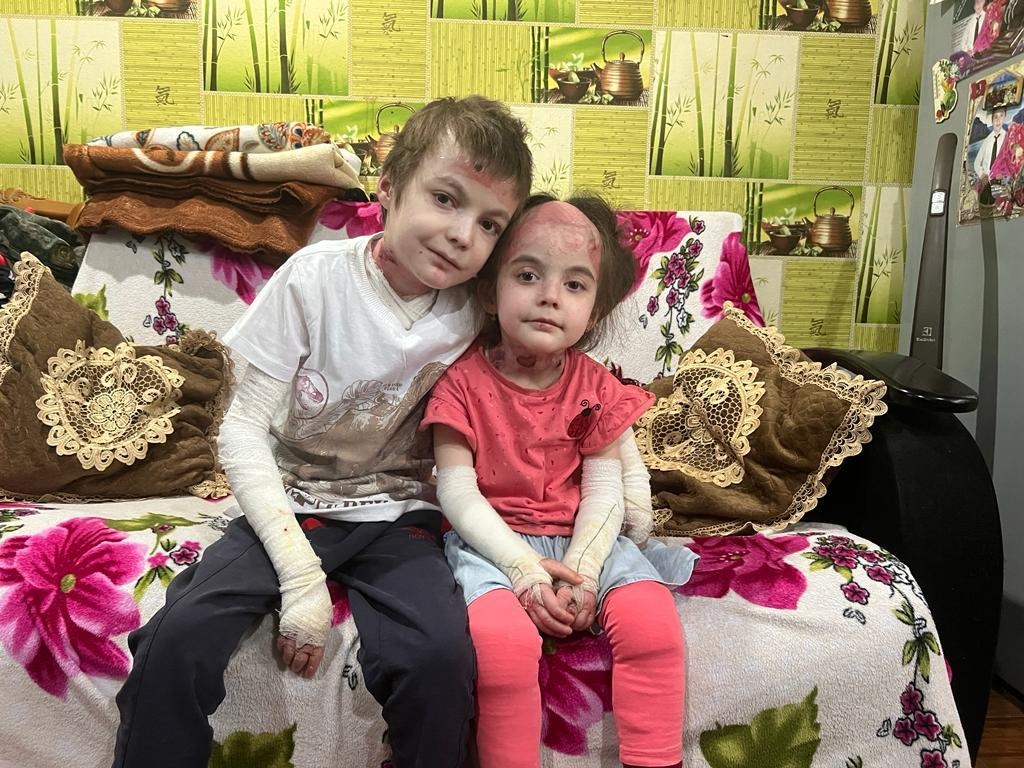 Ибрагиму, Алие и Магомеду для поддержания состояния кожного покрова требуется курс реабилитации!