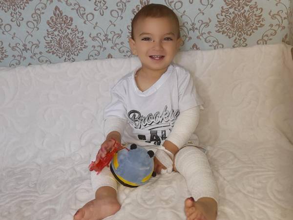 У Мухаммада заболевание кожи, ему нужны специальные мази и бинты для ее защиты!