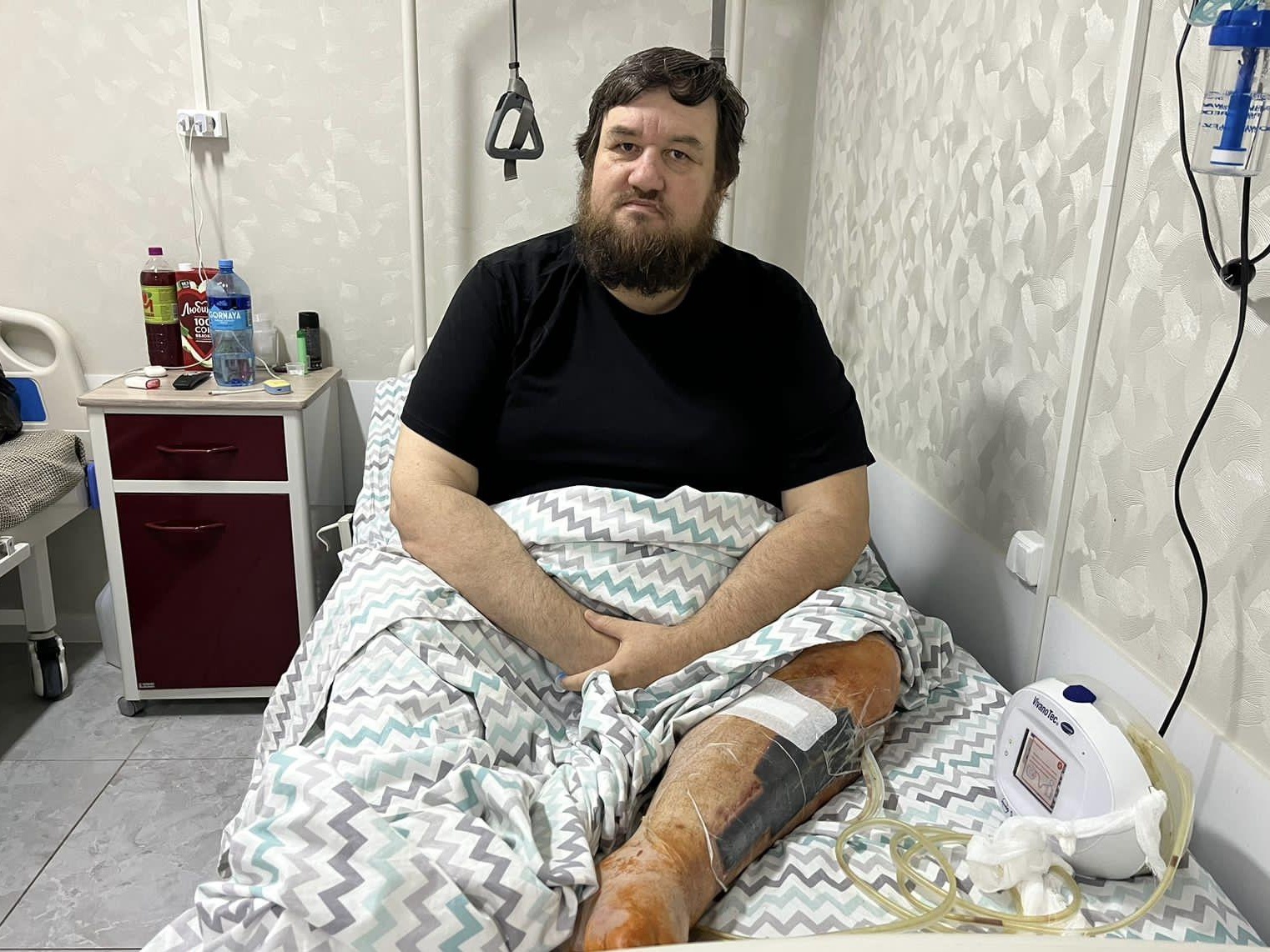 Мухаммад нуждается в срочной операции на ноге, чтобы избежать её ампутации!