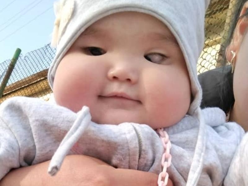 Альфие срочно требуется операция, чтобы сохранить зрение!