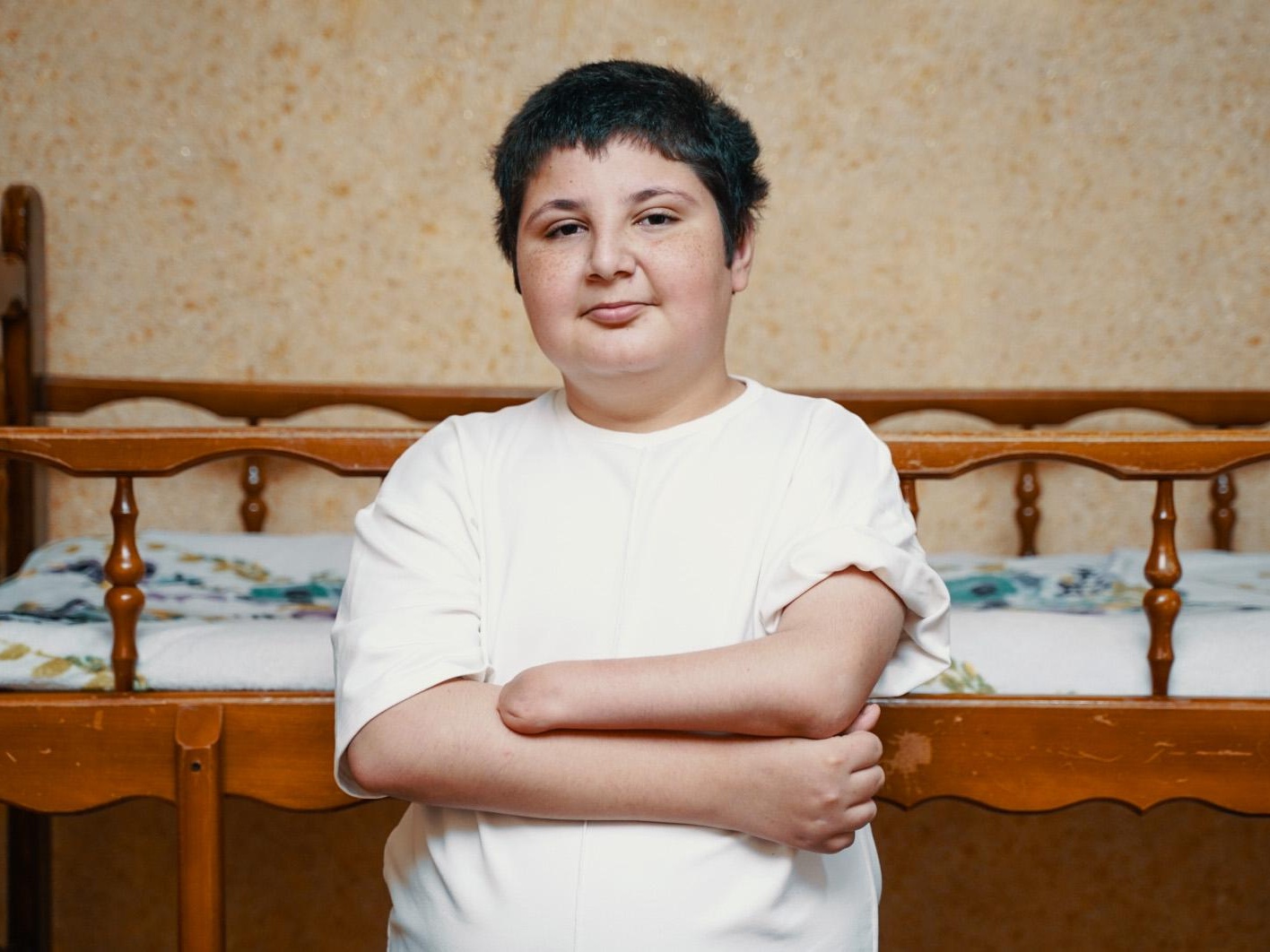 Muhhamad needs a prosthetic hand to live a full life