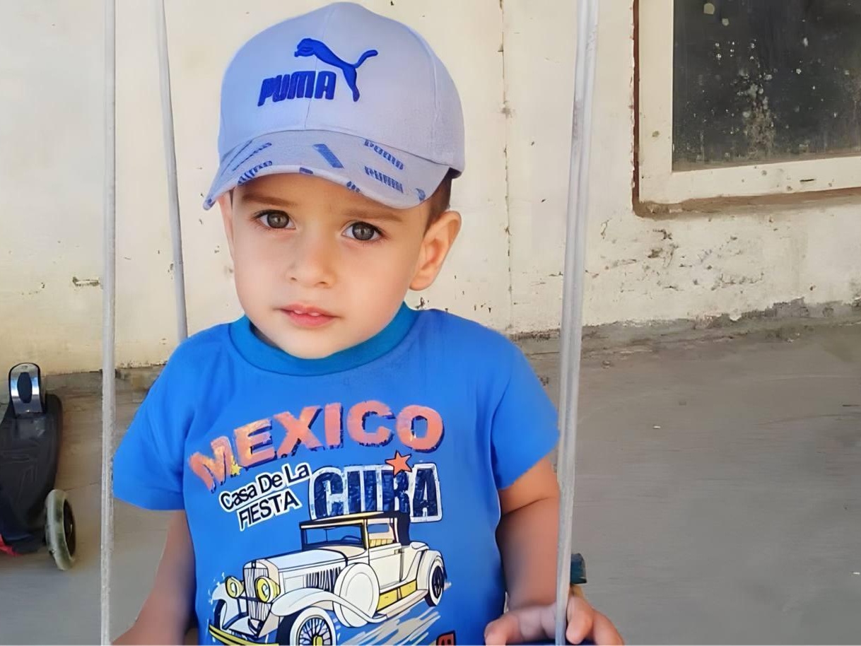 Isa has a disorder of psycho-speech development. He needs rehabilitation to develop his speech and comprehension skills