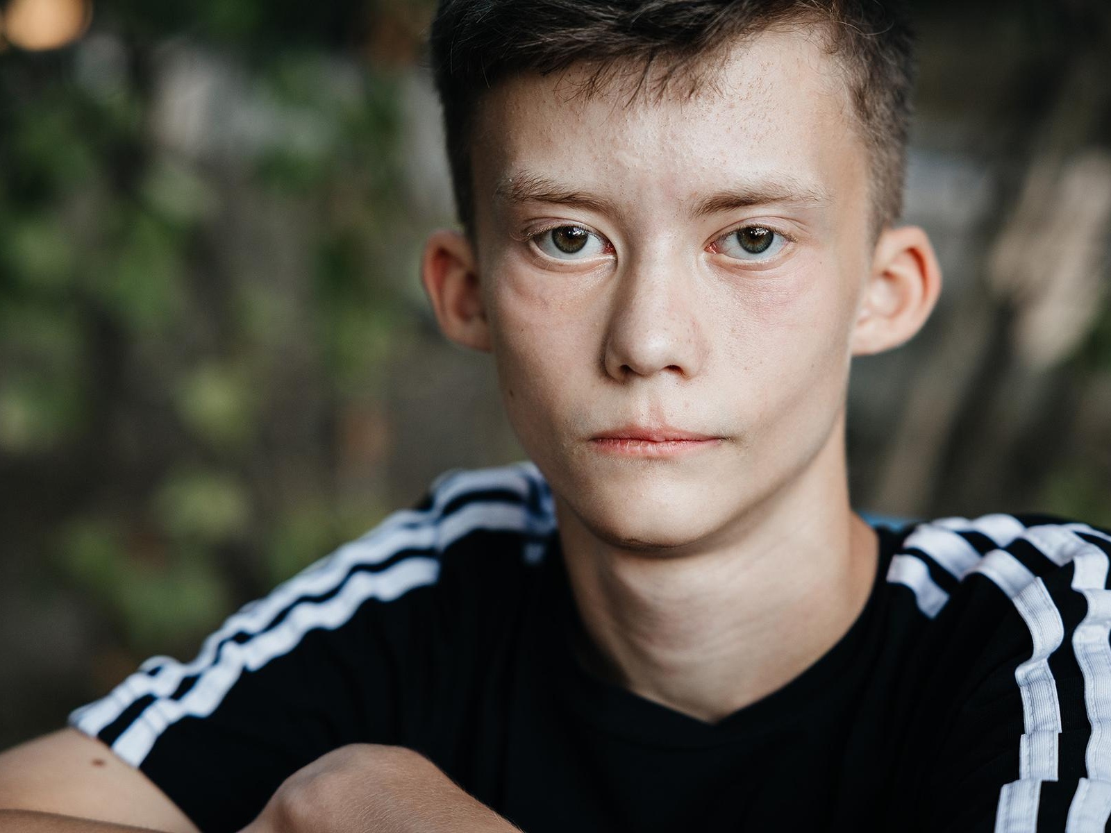 У Захара парализованы мышцы лица – ему нужна операция, чтобы научиться улыбаться