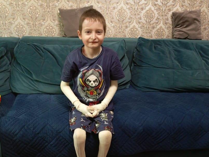 Children with epidermolysis bullosa need to come to the hospital to adjust the treatment regimen and monitor the development of complications!