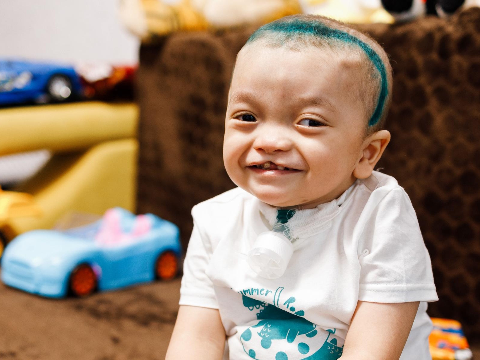 Ichlos, after head surgery, is at risk. A hospitalization reserve is needed