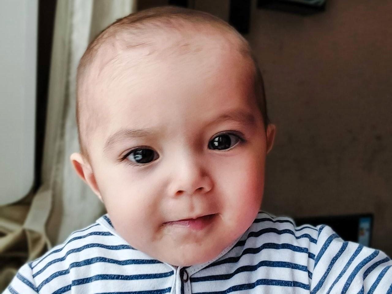 Muhammad has a congenital heart defect and needs surgery!