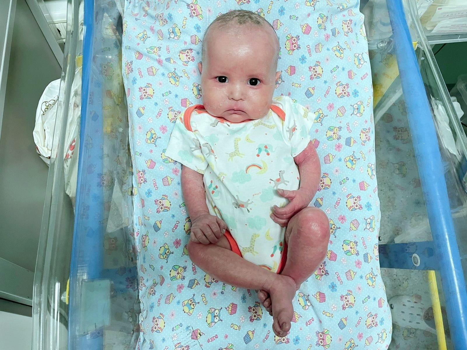 Юсуфу нужны специальные уходовые средства, чтобы легче переносить последствия кожного заболевания!