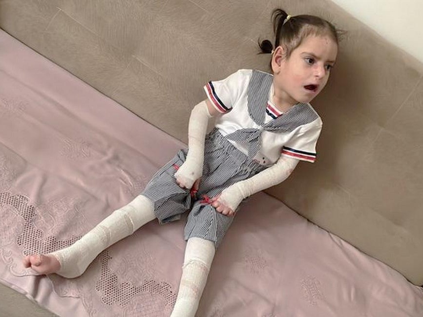 Zukhra and 9 other little wards need to come to Moscow for hospitalization!