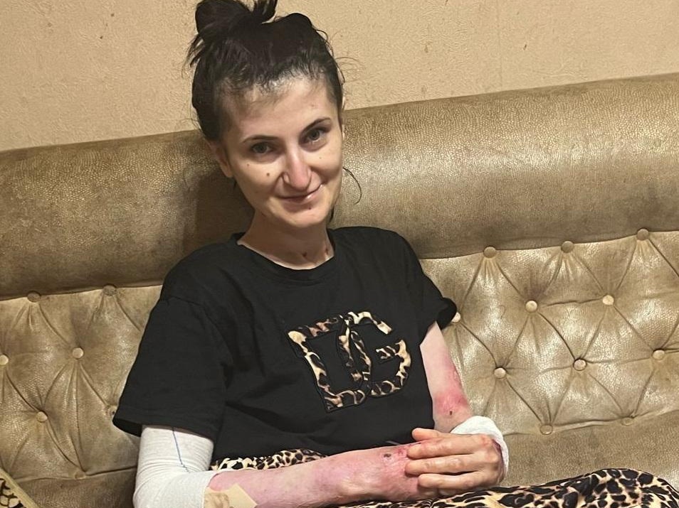 Elena has a genetic skin disease. She needs bandages and care products to protect her!
