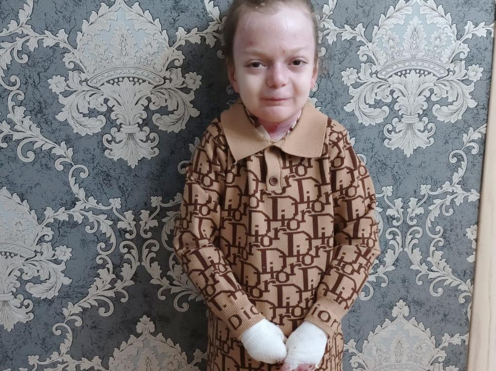 Патимат нуждается в госпитализации и стоматологической помощи!