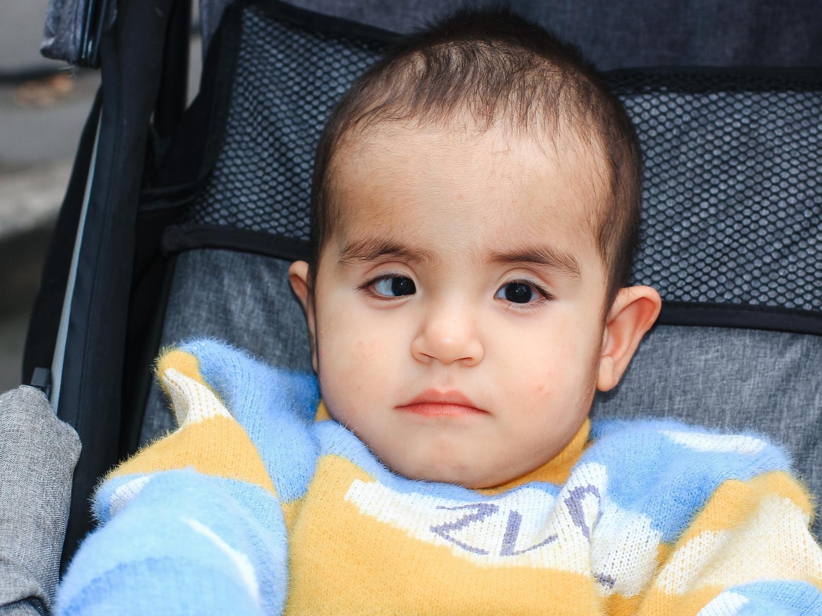 Baby Muhammad needs eye surgery!