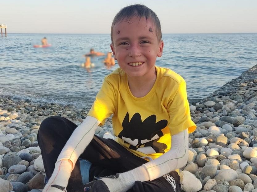Dima has a genetic skin disease, he needs bandages to protect his skin and hospitalization for dental treatment!