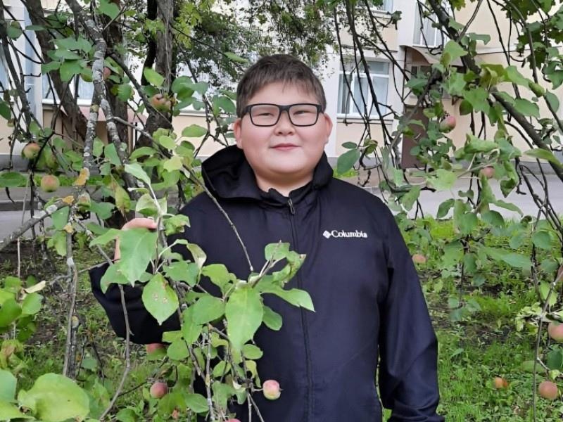 Umar needs sophisticated glasses after unique brain surgery