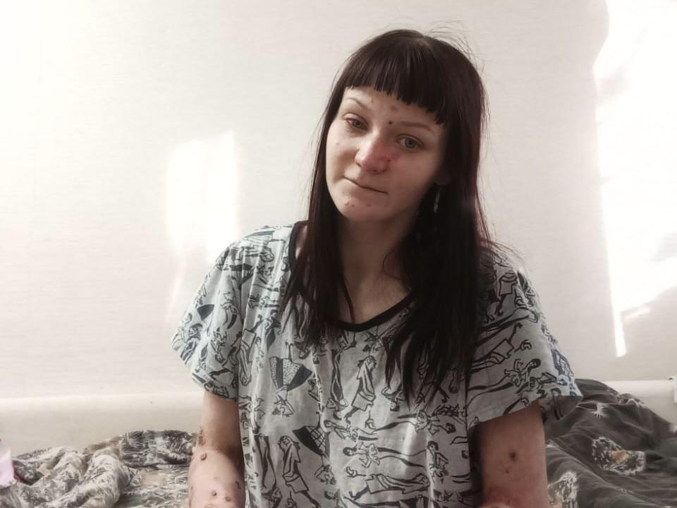 Daria and 6 other adults with epidermolysis bullosa from different parts of our country need hospitalization!