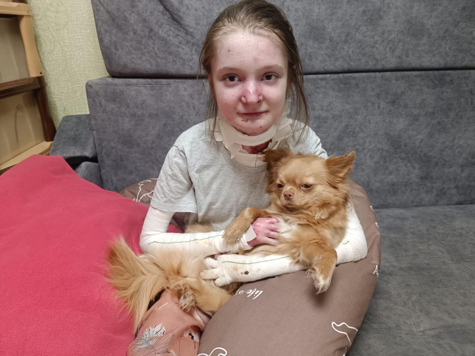 Lisa has epidermolysis bullosa. She needs rehabilitation to cope with the skin disease!