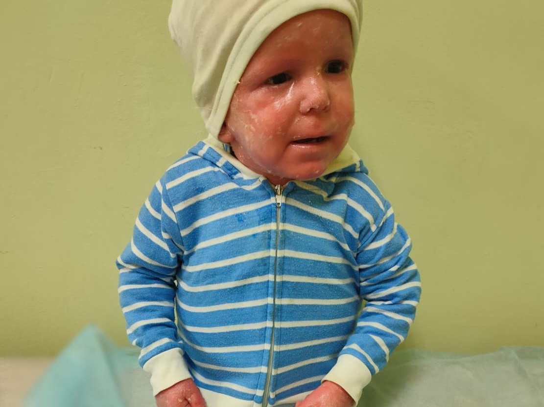 Orphans with incurable diseases need bandages and medicines
