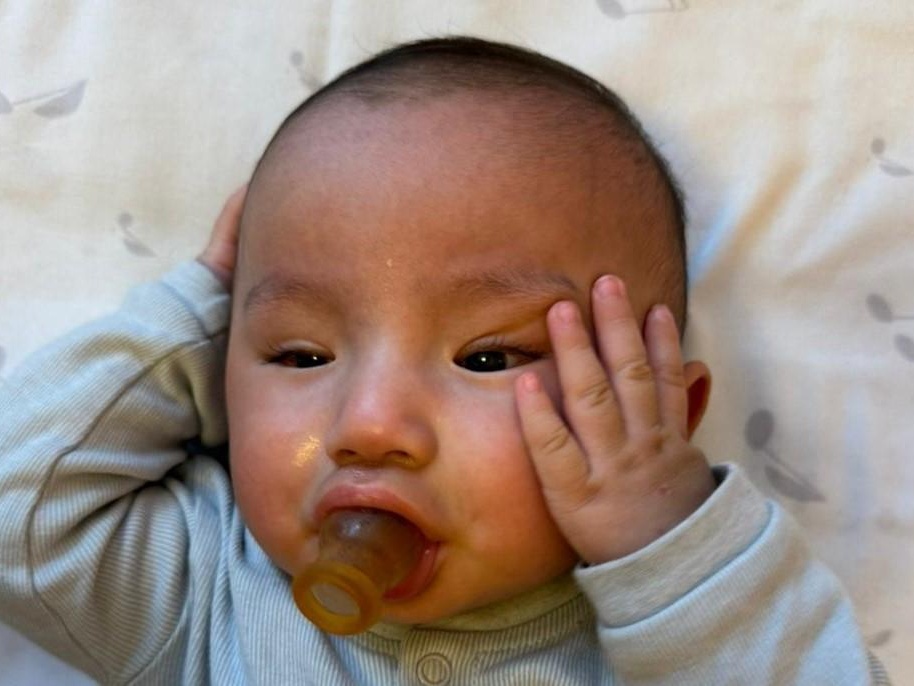 Esen needs surgery to save his eyesight!