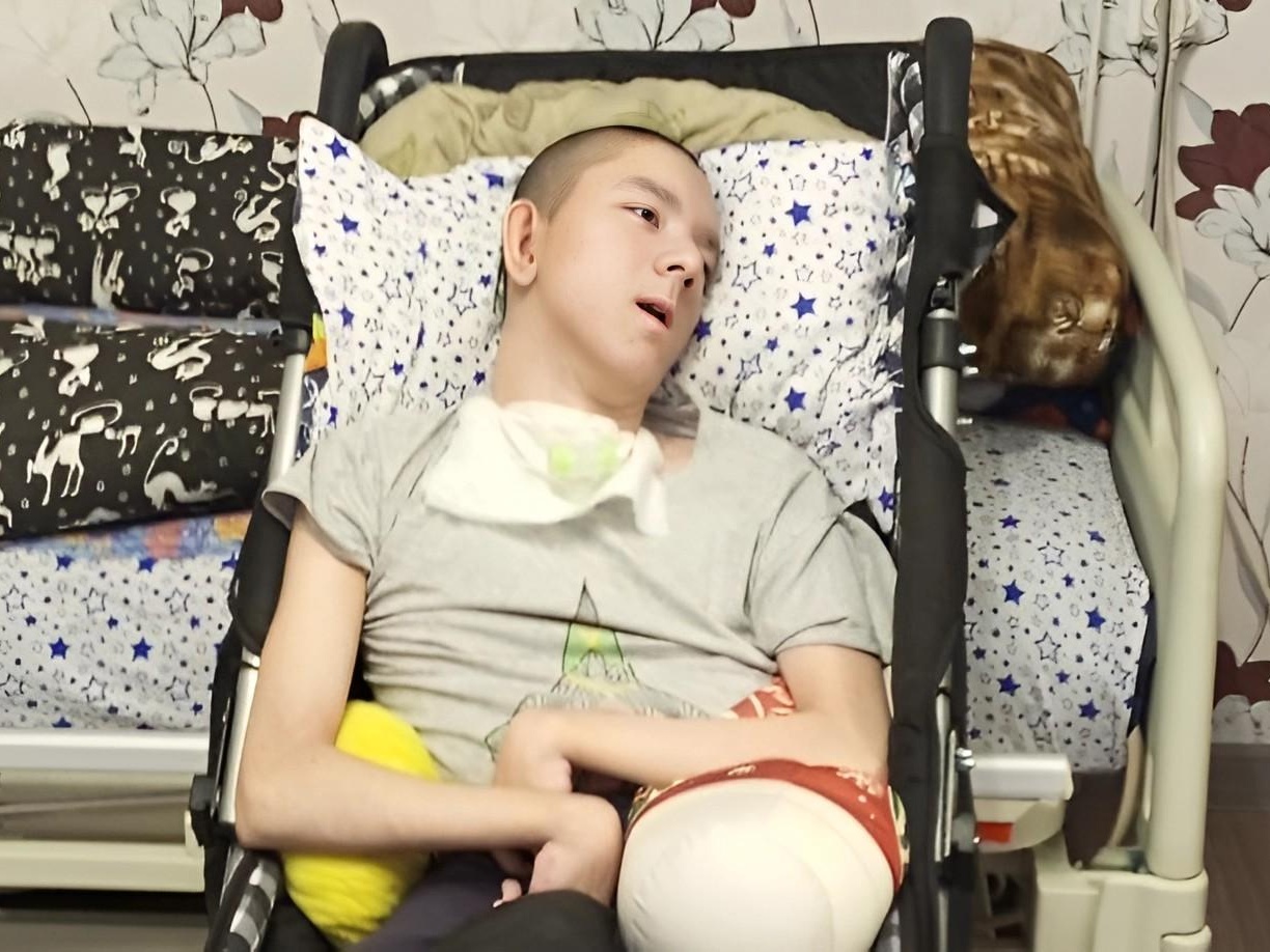 Алишеру нужны трубочки для дыхания и питания, а также шезлонг для купания