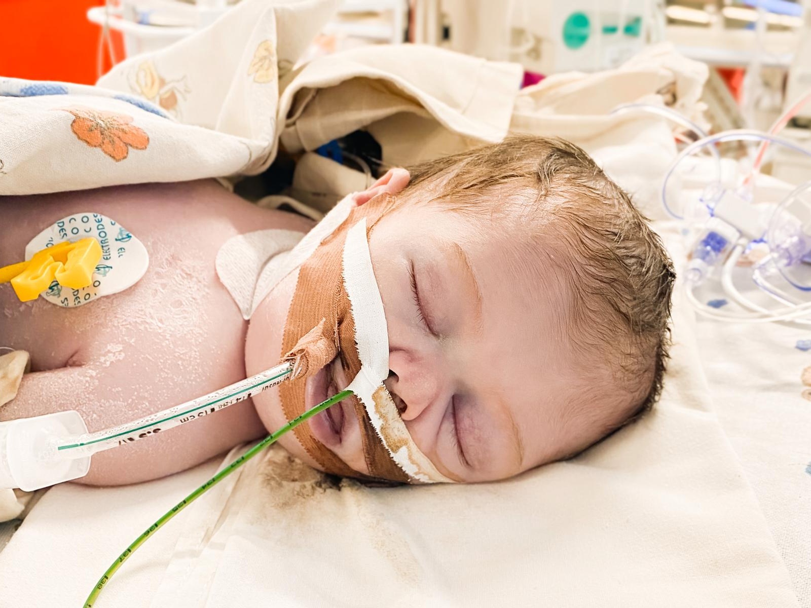 Usmon has a severe heart defect - he needs urgent surgery