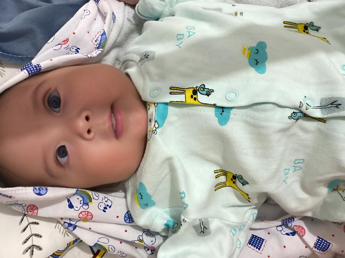 Five-month-old Mohammed needs a second surgery to save his eyesight!