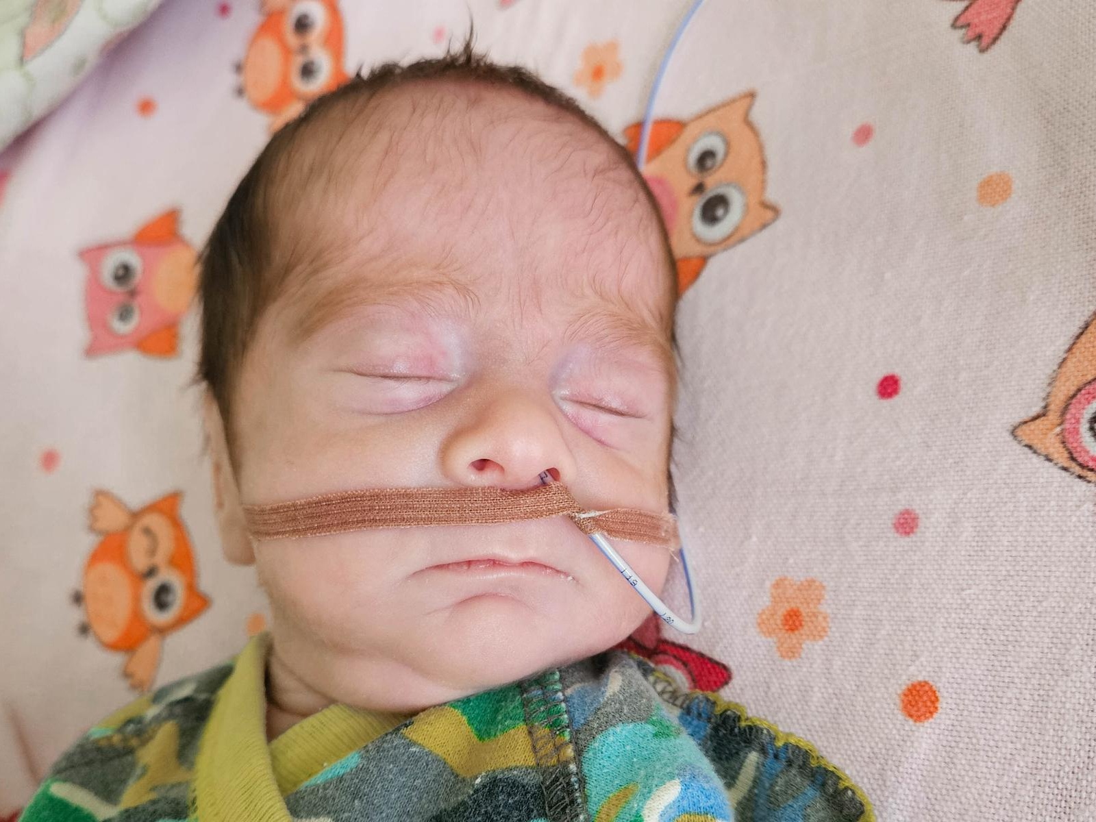 Abdullo was born premature, needs treatment and eye surgery!