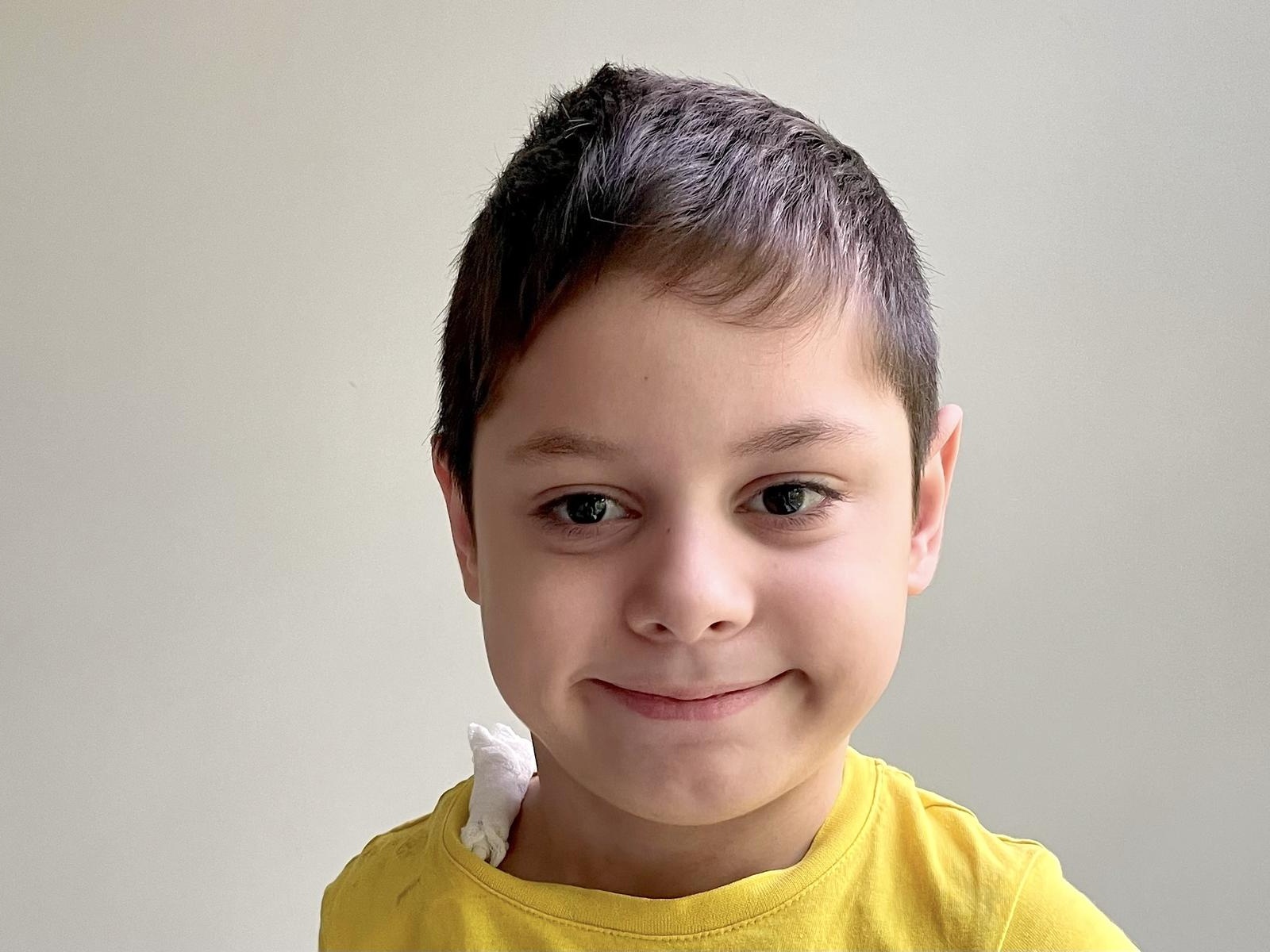 Damir has a serious condition with multiple malformations. He needs urgent treatment!